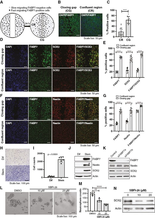 Correlation of fatty acid-binding protein 7 (FABP7) immunoreactivity with neural stem cell markers in migrating GSCs. (A) Schematic illustration of experimental design that combines the scratch assay and fluorescence immunostaining. confluent region (CR), closing gap (CG). (B, C) Representative images (B) and quantitative analysis (C) of FABP7 immunoreactivity in GSCs (A4-004 cells) in the CG and CR 24 hours post scratch formation. (D-G) Coimmunostaining of FABP7 and SOX2 (D, E) or FABP7 and nestin (F, G) in A4-004 cells migrating into the CG and in the CR 24 hours after introduction of the scratch. (H, I) Representative images (H) and statistical analysis (I) of the Transwell assay comparing the migration of A4-004 cells cultured in serum-supplemented DMEM (Dif) (adherent conditions; associated with a more differentiated phenotype) to that of cells cultured in serum-free neurosphere medium (Stem). (J) Western blot showing differential expression of FABP7, SOX2 and nestin in A4-004 cells cultured under adherent (Dif) and neurosphere (Stem) conditions. (K) Western blot showing a reduction in SOX2 protein levels but not nestin upon FABP7 knockdown in A4-004 cells cultured under neurosphere conditions. (L-M) Representative images (L) and histogram (M) showing neurosphere formation in A4-007 cells cultured in the absence (DMSO) or presenceof FABP7 inhibitor SBFI-26. (N) Western blot showing reduced levels of SOX2 in A4-007 cells treated with SBFI-26. N = 2 to 4, in triplicate. **** denotes P < .0001.