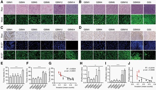 Invasive GBM has low cell density and low proliferative rate.