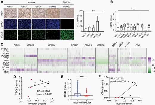 CD44 is more highly expressed in invasive GBM than other CSC-related genes.