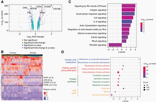 Cellular and molecular profile of invasion in GBM.