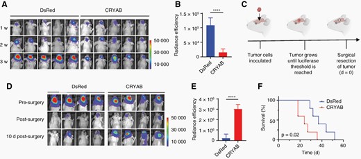 Overexpression of CRYAB increases tumor recurrence after surgical resection.