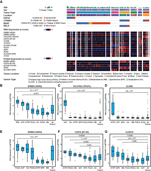 Molecular profiling of ADC targets in pediatric CNS tumors. To characterize expression of potential ADC targets in pediatric CNS tumors, we analyzed publicly available bulk-RNA sequencing, selected whole-genome sequencing (WGS), and proteomic (mass spectrometry) data from the CPTAC database. This dataset included 188 tumors from seven major subtypes, including pediatric high-grade glioma (PHGG), pediatric low-grade glioma (PLGG), medulloblastoma (MB), ependymoma (EPN), ganglioglioma (GG), atypical teratoid/rhabdoid tumor (AT/RT), and adamantinomatous craniopharyngioma (ACP). Relevant oncogenic drivers were analyzed for each histologic subtype, including H3F3A in PHGG, BRAF in PLGG, CTNNB1 in CP, and RELA in ependymoma (A). ERBB2/HER2 RNA expression was enriched relative to other tumors in EPN (P = 9.1 × 10−10) and ACP (P = .001) (B), though only EPN showed enrichment in proteomic data (A). TACSTD2/TROP2 RNA was strongly enriched in ACP (P = 6.5 × 10−8) and very low in other subtypes (C). CLDN6 RNA was strongly enriched in AT/RT (P = 2.8 × 10−6), with low expression in other subtypes (D). ERBB3/HER3 RNA showed moderate expression in multiple subtypes, with slight enrichment in PLGG (P = 3.3 × 10−6) (E). CD276/B7-H3 RNA was moderately expressed by all tumors, with relative enrichment in ACP (P = .042), AT/RT (P = .0003), MB (P = .004), and PHGG (P = 7 × 10−5) (F). CLDN18 RNA showed very low expression in all subtypes, with slight relative enrichment in AT/RT (P = .0028), EPN (P = 8.3 × 10−5), and MB (P = .036) (G). All statistical comparisons performed using a Student’s t-test, unpaired, 2-sided with α = .05.