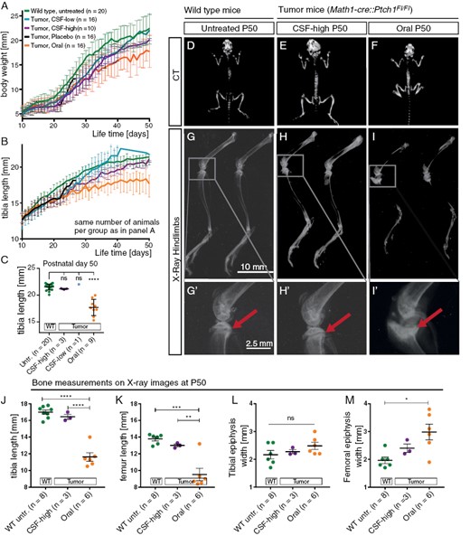 Intraventricular Vismodegib does not affect bone growth and macroscopic bone morphology. A: Body weight from P10 to P50 shows reduced weight gain in orally treated mice and to lesser extent in CSF-high-treated mice. B,C: Tibia length at P10 to P50 (B) and quantification of tibia length at P50 (C) show drastically reduced tibia length after oral Vismodegib treatment compared to untreated wild type siblings. D–F: CT images at end of observation show short stature and shortened tibiae in orally treated mice while CSF-high-treated mice show no anomalies of bone anatomy compared to untreated wild type siblings. G–I: X-rays of hindlimbs show shortened tibia and deformed fibula as well as dysmorphism of the proximal epiphysis of the tibia after oral treatment. No comparable changes were detected after CSF-high treatment. G’–I’: Close-ups of the knee joint confirm open growth plates of the tibia in healthy untreated siblings and CSF-high-treated siblings but premature closure after oral treatment (arrows). J–M: Quantification of tibia length, femur length, tibial epiphysis width and femoral epiphysis width measured on X-rays from mice at P50. ns = p > .05, *p < .05, **p < .01, ***p < .001, ****p < .0001. Dunnett’s test was applied for comparison of each group to untreated wild type in panel C. Tukey’s test was applied for comparing the mean of each group with the mean of every other group in panel J–M.