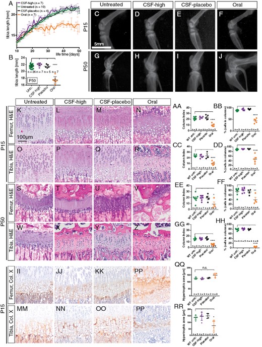 Intraventricular Vismodegib does not affect microscopic bone morphology of wild-type mice. A, B: Tibia length of CSF-placebo and CSF-high-treated mice is comparable to untreated mice but significantly shorter in orally treated mice at P50. C–J: Representative X-rays of the knee joint reveal normal anatomy with clearly discernible growth plate in untreated (n = 3), CSF-high (n = 4), and CSF-placebo (n = 3) treated mice but marked dysmorphism and a closed growth plate after oral treatment. K–Z: H&E stainings of the growth plate of femur and tibia at P15 and P50 reveal maintained columnar organization in untreated, CSF-high and CSF-placebo treated mice but disrupted column formation after oral treatment. AA–HH: Quantification of column index and percentage of cells in columns (*p = .0354 in OO, *p = .0019 in PP). II–PP: Immunohistological stainings for collagen X illustrate comparable width of the hypertrophic zone in untreated, CSF-high and CSF-placebo treated mice but premature closure of the epiphyseal plate after oral treatment with an absent proliferative zone. QQ–RR: Width of hypertrophic zone in femura does not differ between treatment groups but is significantly lower in tibiae of orally treated mice than in tibiae of untreated WT mice (*p = .0173). Dunnett’s test for was applied in all quantifications (AA–HH and QQ, RR), comparing each treatment group to untreated mice. ****p < .0001.