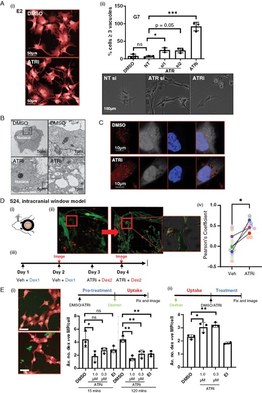Inhibition of ATR causes a decrease in active macropinocytosis and endocytic processing. (A)(i) An accumulation of large vacuoles following either treatment with ATRi was observed in all 3 cell lines, E2 shown as an example. (ii) Number of vacuoles per cell following ATRi or RNAi of ATR was quantified in G7 cells, statistical significance was determined using a 1-way ANOVA and Dunnett’s test. (B) Electron microscopy of G7 cells showed vacuoles to be single membrane bound. (C)(i) E2 cells incubated with 70 kDa Texas red dextran (red) alongside ATRi or DMSO. White = whole cell stain, blue = DAPI. (D) Treatment of mice with ATRi (VX970) in an intracranial window model causes an accumulation of labeled dextran in vivo. (i) Multiphoton imaging and processing were used to detect the uptake of fluorescent dextran in to GFP-S24 cells in the mouse brain. (ii) Five mice were treated with DMSO and Cascade blue labeled dextran followed by imaging, then treated with ATRi and Texas red labeled dextran followed by second imaging in a longitudinal experiment (1 mouse received only ATRi plus CB-Dex). (iii) Pearson’s coefficient was calculated under each treatment condition for each mouse to estimate colocalization of dextran with S24-GFP cells using Imaris colocalization tool. >3 images per imaging session per mouse, image data plotted individually (small points) or as mean for each mouse (large points), color coded for each mouse. **P < .01, Student’s t-test. (E) Timed experiments demonstrate ATRi inhibits both the uptake and downstream degradation of internalized dextran. (i) G7 cells were incubated with DMSO, ATRi, or EIPA for 15 min or 2 h before incubation with labeled dextran. (ii) G7 cells were pre-incubated with dextran to allow uptake before addition of DMSO, ATRi, or EIPA. Data represents 3 biological repeats, 2000–4000 cells quantified via high-throughput imaging per condition per repeat. Statistical significance was determined using a 1-way ANOVA and Dunnett’s test. *P < .05; **P < 0.01, n.s = not significant.