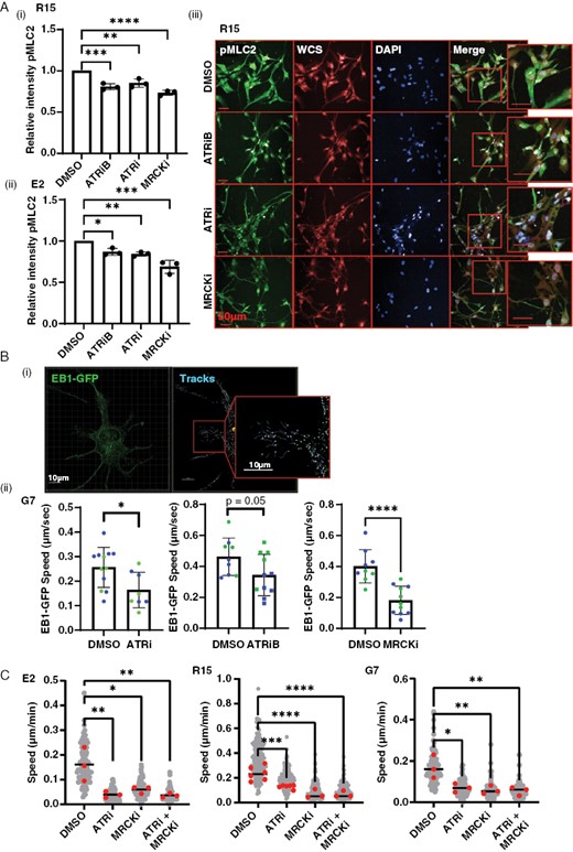 ATRi causes a reduction in actin cytoskeleton and microtubule plasticity. (A) R15 and E2 cells were incubated with DMSO, 1 µM ATRiB, 1 µM ATRi, or 1 µM MRCKi for 6 h before staining with antibody against pMLC2 , whole cell stain , and DAPI followed by high-throughput imaging and automated analysis. Images from R15 shown as an exemplar. Data from 3 biological repeats, 2000–4000 cells imaged per condition each repeat. Bars are mean ± SD. Statistical significance was determined using one way ANOVA and Dunnett’s test: **P > .01, ***P > .005. (B)(i) EB1-GFP was transiently expressed in G7 cells, incubated with DMSO, ATRi, ATRiB, or MRCKi for 16 h (ii), followed super-resolution time-lapse imaging and 3D automated tracking of EB1-GFP foci in Imaris. EB1-GFP foci tracking data from two biological repeats (color coded). Each point represents data from a single image (1–3 cells) with >100 EB1-GFP foci tracked per image. *P < .05, Student’s t-test. (C) G7, E2, and R15 cells were plated subconfluently and treated with either DMSO, ATRi (1 µM VE822), MRCKi (1 µM BDP9066), or combined treatment for 24 h followed by time-lapse microscopy and single-cell tracking. Statistical analysis = 1-way ANOVA; *P < .05, **P < .01, ***P < .001, ****P < .0001.
