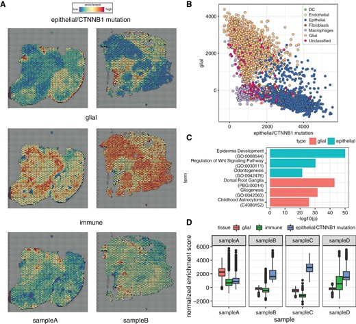 Gene set enrichment identifies epithelial (eg, tumor), glial, and immune spatial gene expression compartments within ACP tissue samples. (a) Example images of single-sample gene set enrichment analysis for Apps epithelial/CTNNB1 mutation, glial, and immune gene sets, respectively; red spots indicate high enrichment, and blue spots indicate low enrichment. (b) Scatterplot of enrichment scores for epithelial/CTNNB1 mutation and glial modules; spots are colored by cell state as shown in Figure 1b. (c) Enriched terms (ontologies, pathways, processes, diseases, cell types) for gene markers identified for top epithelial/CTNNB1 mutant (blue bars) and glial (red bars). (d) Boxplot of enrichment score distributions for tumor, immune, and glial signatures stratified by spatial gene expression sample.