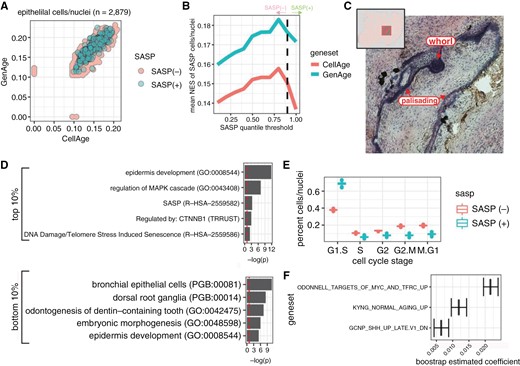 Transcriptional signature of SASP cells in ACP epithelial tissue. (a) Scatterplot of cells and nuclei according to normalized enrichment score of CellAge and GenAge gene sets. SASP cells are identified as those in the top 10% of enrichment for the SenMayo gene set. (b) SenMayo percentile versus NES for CellAge and GenAge gene sets; the dashed line indicates the 90th percentile. (c) Example of SASP spots in spatial gene expression dataset (sample A). Histological stain with arrows pointing to areas labeled as SASP positive. (d) Enrichment profiles for enriched genes identified in cells/nuclei with the top and bottom 10% SenMayo NES scores (eg, high/low SASP). (e) Boxplot of relative percentages for predicted cell cycle stage for cells/nuclei (bootstrap n = 1,000) stratified by SASP status. f. Genesets were identified as contributing to the SenMayo enrichment score through cross-validated LASSO regression (bootstrap n = 1,000).