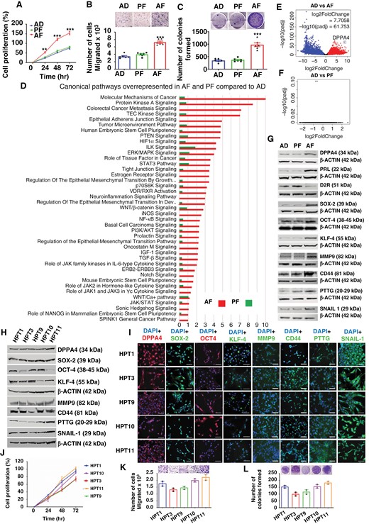 DPPA4 expression is elevated in aggressive PitNETs. (a to c) The aggressiveness of rat pituitary tumor (RPT) cells obtained from prenatal alcohol-fed (AF), pair-fed, (PF), ad libitum-fed (AD) rats was determined by cell proliferation (a), cell migration (b), and colony formation (c); n = 6. (d to f) RNA-seq data of AF, PF, and AD cells are analyzed by IPA and overrepresented canonical pathways are shown by histograms (d) and the expression difference between AD vs AF and AD vs PF are shown by volcano plots (e and f). (g) Western blot data of DPPA4, PRL, D2R, stem cell marker, and tumor aggressiveness marker proteins in AF, PF, and AD cells; n = 6. (h to i) DPPA4 and stem cell factors are expressed in aggressive patient-derived PitNET (HPT) cells. Expression of DPPA4 and various stem cell regulatory proteins were detected by Western blot (h) and immunofluorescence (i) in 5 different human pituitary tumor cells (HPT1-5) prepared from patient-derived tumor tissues that expresses more DPPA4 and stem cell regulatory proteins than those tumor tissues produced non-viable cells (Supplementary Figure 7). (j to l) Cell proliferation (j), cell migration (k), and colony formation (l) profiles of HPT1-5 cells (n = 2). Scale bar represents 100 μM in immunofluorescence figures. Data shown in histograms are mean ± SEM and were analyzed using 1-way or 2-way analysis of variance (ANOVA) with the Newman Keuls post hoc test or Dunnett’s multiple comparison test *P < .05, **P < .01, and ***P < .001 between AF and controls (AD, PF).