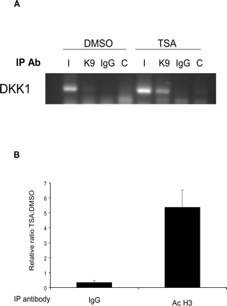 Chromatin immunoprecipitation analysis of the DKK1 promoter. (A) Histone-DNA complexes from DMSO- or TSA-treated D283 cells were immunoprecipitated with IgG or antiacetyl-histone (K9) antibodies and amplified with DKK1 primers. Acetyl histone (K9) associated with DKK1 in TSA-treated but not control (DMSO-treated) cells. I, input control; K9, acetyl-histone; IgG, isotype control. (B) Densitometric quantification of ChIP analysis: fivefold increase in DKK1 promoter association with acetylated histone in TSA-treated cells compared to DMSO-treated controls (P < 0.001).