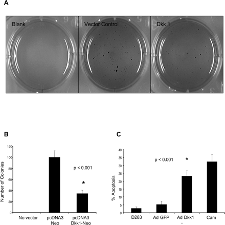 Tumor suppression by DKK1. (A) DKK1-transfected cells produced fewer colonies than control vector on soft agar as visualized by methylene blue staining. (B) Colony counts reveal significantly fewer colonies in DKK1-transfected D283 cell cultures compared to control vector (n = 3, P < 0.001). (C) Ad-mediated DKK1 expression in D283 cells leads to increased apoptosis compared to Ad-GFP controls (n = 3, P < 0.001).