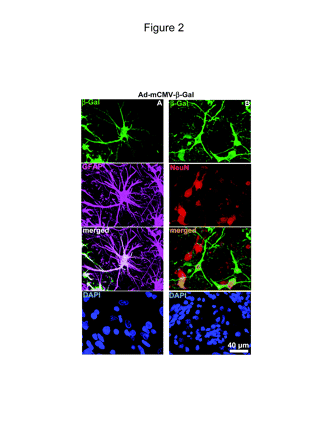 In vivo transgene expression in astrocytes and neurons of dogs injected with adenovirus vector-murine cytomegalovirus-β-galactosidase (Ad-mCMV-β-Gal). Dogs were injected in the parietal neocortex with Ad-mCMV-β-Gal, 8 × 107 PFU in 5 μl per injection site. After seven days, transgene expression was detected in 75-μm coronal sections. Confocal pictures show neurons, as labeled with anti-neuronal nucleus (NeuN) antibody (red); astrocytes, as detected with anti-glial fibrillary astrocytic protein (GFAP) antibody (magenta); and β-Gal expression (green). Nuclei were stained with 4′,6-diamidino-2-phenylindole (DAPI) (blue). (A) Pictures show β-Gal expression from Ad-mCMV-β-Gal in astrocytes (GFAP, magenta). Colocalization of GFAP and β-Gal is depicted in white. (B) Pictures show β-Gal expression from Ad-mCMV-β-Gal in neurons (NeuN, red). Colocalization of NeuN and β-Gal is in orange.