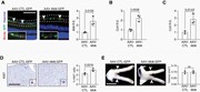 Midkine is sufficient for murine Nf1-OPG growth. (A) Left, immunof...