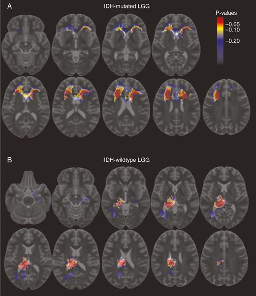 Differences in location distribution between IDH wild-type and mutated low-grade gliomas. Voxel-color indicates corrected P-value with color bar for scale; (a) regions more often occupied by IDH-mutated low-grade gliomas; (b) regions more often occupied by IDH wild-type low-grade gliomas.