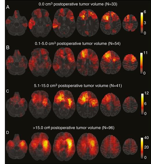 Spatial distribution heatmaps of WHO 2016 grade II glioma stratified according to postoperative tumor volume. The color bars on the right indicate the frequencies corresponding with the color of the voxels; (a) gliomas with a total resection (0.0 cm3 residue); (b) gliomas with a postoperative tumor volume of 0.1–5.0 cm3; (c) gliomas with a postoperative tumor volume of 5.1–15.0 cm3; (d) gliomas with a postoperative tumor volume of more than 15.0 cm3.