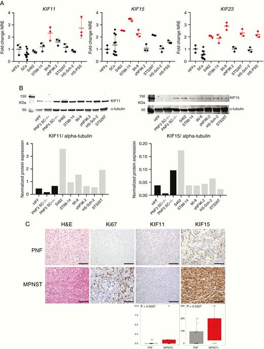 Mitotic kinesins KIF11, KIF15, and KIF23 are highly expressed in human MPNSTs and derived cell lines. A. RT-qPCR normalized relative expression (NRE) of KIF11, KIF15, and KIF23 in CCD-1112Sk fibroblasts (HFFs), 10 human SC primary cultures, and 7 human MPNST cell lines. Expression values are plotted as the fold change NRE relative to the mean NRE in the HFF cultures. In red, those significantly overexpressed (one-way ANOVA). B. Top: Western blot of KIF11 and KIF15 proteins in HFFs, 2 PNF-SC cultures, and 6 MPNST cell lines. Bottom: Normalized KIF11 and KIF15 protein expression (vs. α-tubulin protein) in HFFs, 2 PNF-SC cultures, and 6 MPNST cell lines. C. Top: H&E staining and immunohistochemical expression of Ki67, KIF11, and KIF15 in a tissue microarray including 16 PNFs and 14 MPNSTs. Scale bars, 200 μm. Bottom: HScore values of KIF11 and KIF15 immunodetection in PNFs and MPNSTs (Mann–Whitney test).