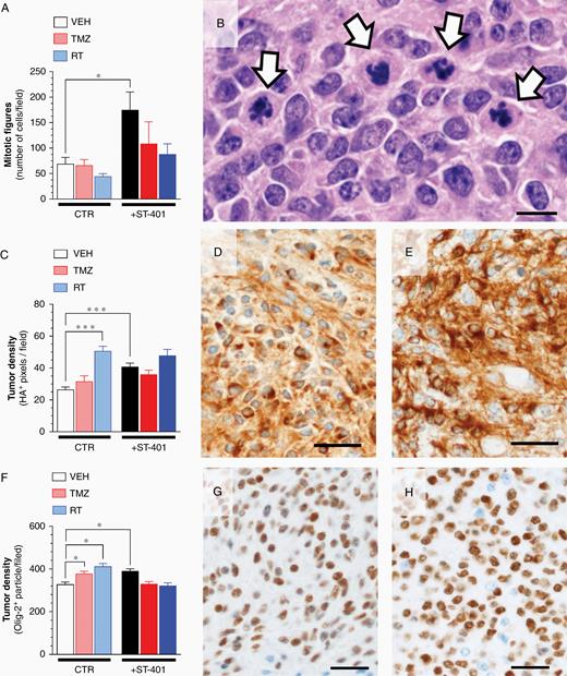 ST-401 disrupts mitosis and enhances PDGFB-glioma tumor density. (A) ST-401 increases the number mitotic figures in PDGFB-glioma as determined by H&E histopathological analysis. (B) Representative H&E stained section of PDGFB-glioma treated with ST-401 illustrating disrupted mitotic figures (arrows). Scale bar = 100 μm. (C) RT and ST-401 increase PDGFB-glioma tumor density as determined by HA imnumostaining. (D–E) Representative HA immunostaining of PDGFB-glioma from CTR (D) and ST-401 arms (E). Scale bars = 20 μm. (F) TMZ, RT and ST-401 increase PDGFB-glioma tumor density as determined by olig-2 imnumostaining. (G–H) Representative olig-2 immunostaining of PDGFB-glioma from CTR (G) and ST-401 arms (H). Tumor density (ie, % area) of positively-stained pixels counted by unbiased semi-quantitative analysis using Image J. Results are mean ± SEM from n = 5–8 brain sections per arm. Two-way ANOVA analysis followed by Tuckey's post-test indicated significant difference of ***P < .001, **P < .01 and *P < .05.