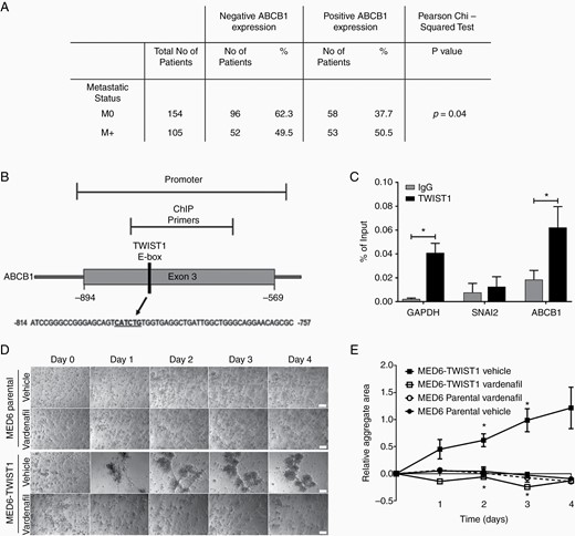 TWIST1 regulates ABCB1. (A) Membranous ABCB1 IHC staining of DKFZ TMA and Nottingham TMA was scored and correlated with metastatic status (M0/M+) in a total of 259 patients (Pearson’s chi-squared exact test P = .04). (B) Schematic of the E-box binding site in the Exon 3 promoter region of ABCB1. (C) ChIP qPCR analysis of the promoter regions in GAPDH, SNAI2, and ABCB1, showing enrichment with TWIST1 antibody for GAPDH and ABCB1 compared with IgG antibody control. Data are expressed as a percentage of the input (paired Student’s t-test *P ≤ .05; n ≥ 3). (D and E) MED6 and MED6-TWIST1 (2.6 × 104 cells/well) cells were treated with vardenafil (10 µM) or vehicle (H20) at days 0–4 in the 3D-BME model. (D) Time-lapse images were taken at ×10 magnification (scale bars represent 100 µm). (E) The mean aggregate area was quantified from time-lapse images taken between days 0 and 4 (unpaired t-test with Sidak–Bonferroni correction *P ≤ .05; n ≥ 2).