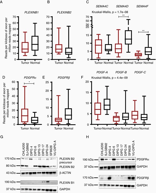 Aberrant gene and protein expression pattern in DIPG tumor tissues cell lines. (A–C) Box and whisker plots show the relative gene expression of PLEXINB1 and PLEXINB2 receptors and their known ligands, SEMA4C, SEMA4D, and SEMA4F in normal and DIPG tumor samples. The mRNA expression is shown in reads per kilobase of exon per million reads mapped (RPKM). (D–F) mRNA expression of PDGFR (α and β) and their preferred ligands PDGF-AA, PDGF-BB, and PDGF-CC in both normal and DIPG tumor samples. (* denotes P < .05, and ** denotes P < .01). (G,H) Immunoblots of receptors, PLEXINB2, PLEXINB1, PDGFRα, and PDGFRβ show aberrant expression in DIPG tumor cell lines. CHLA 200 and SJ-GBM2 are non-DIPG cell lines and serve as controls. DIPG cells: DIPG 4, DIPG 6, DIPG 13, DIPG 17, DIPG 24, SF-8628, and VU-DIPG A. β-ACTIN and GAPDH were used as loading controls.