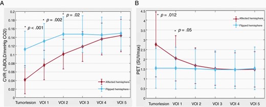 CVR and PET impact of diffuse gliomas on surrounding brain tissue. (A) Line plot of mean CVR values around diffuse glioma. The plot depicts the increase in mean CVR values from the diffuse glioma outward in the surrounding “healthy” brain tissue and also shows lower CVR values in the affected hemisphere. BOLD-CVR values represent the mean values of the 2 hemispheres (red line for affected hemisphere and blue line for flipped hemisphere). (B) Line plot of mean PET values around diffuse glioma. The plot depicts the decrease in mean PET values from the diffuse glioma outward in the surrounding “healthy” brain tissue and also shows higher PET values in the affected hemisphere. PET values represent the mean values of the 2 hemispheres (red line for affected hemisphere and blue line for flipped hemisphere).
