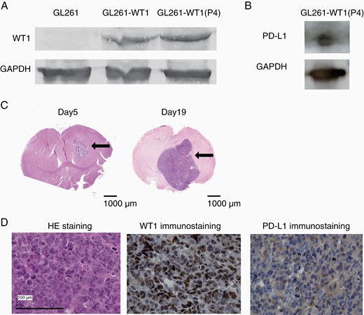 Establishment of PD-L1 and WT1 doubly expressing glioblastoma cells. (A) Western blotting analysis of WT1 protein for GL261 and GL261 transduced with WT1 cDNA (GL261-WT1). P4 means the GL261-WT1 cells that were four times passaged in culture. (B) Western blotting analysis of PD-L1 protein for GL261-WT1-luc. (C) Representative HE staining of brains on days 5 (left) and 19 (right) after the transplantation with GL261-WT1 glioblastoma cells. Intracranial tumor masses were indicated by arrows. (D) Representative HE and immunohistochemical staining of WT1 and PD-L1 proteins of resected tumors. WT1 and PD-L1 proteins were detected in the cytoplasm and on the cell surface, respectively.