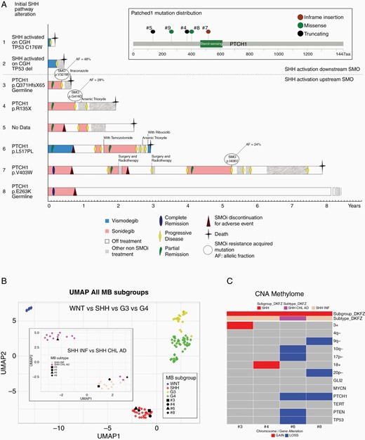 Patients’ treatment and molecular alteration. Swimmer plot representing patients’ outcome starting at the beginning of the first SMOi treatment (a). Patients are segregated by SHH activation downstream SMO, above the dotted line, or SHH activation upstream SMO, below the dotted line. The first column described initial SHH pathway molecular alteration based on CGH, methylome analysis, and/or sequencing. Event, including responses, progressive disease, discontinuation, or death are represented on the patient line as well as other relevant treatment targeting SHH pathway or resistance. For patients who underwent a new biopsy at progression, SMO mutation are reported with their allelic fraction in the tumor biopsy. Unsupervised clustering of methylation pattern according to medulloblastoma subgroups using UMAP showed that the 4 patients were clustering with the previously published SHH medulloblastoma (b). SHH subgroups affiliations between infant (INF) or child and adolescent (CHL AD) of patients tumors were consistent with age at diagnosis. Patient #6 was 13 years old while the remaining 3 patients were of 4 years old or below at diagnosis (c). copy number profils infered from methylation array showing recurrent copy number alteration in SHH medulloblastoma. SHH, Sonic Hedgehog; SMOi, smoothened inhibitor.