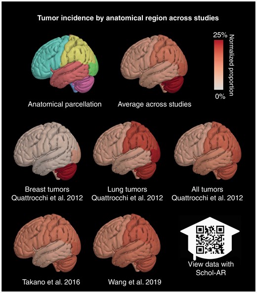 Surface renderings illustrating the patterns of anatomical localization of brain metastases reported in several papers included in the review. The images visualize probability estimates of tumor location assessed for each of the frontal, parietal, temporal, and occipital lobes, the brainstem, and the cerebellum (first row, first column). The surfaces are colored to show high probability in red (25% of cases including both hemispheres) and white (approaching zero probability). Probability estimates were computed by aggregating lesion extent from plots and tables of the listed reviews, normalizing by region volume, and normalizing. A composite plot was generated to show the average probability across all studies included in the figure. The data may be visualized in augmented reality using the mobile application Schol-AR, which can be found at https://www.schol-ar.io/. 3D visualizations were made using the Quantitative Imaging Toolkit (QIT) and with augmented reality functionality provided by Schol-AR (https://www.schol-ar.io/).53