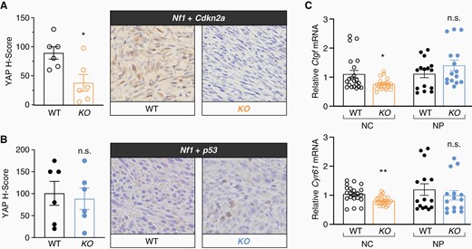 RABL6A-null tumors display reduced YAP activity in a context-dependent manner. Representative YAP IHC images (200X magnification) from WT and Rabl6 KO mice in (A) Nf1 + Cdkn2a and (B) Nf1 + p53 primary MPNSTs with H-Score quantification graphed on the left. (C) Relative mRNA levels of YAP target genes, Ccn2 (Ctgf) (top) and Ccn1 (Cyr61) (bottom) from WT versus Rabl6 KO NC (Nf1 + Cdk2na) and NP (Nf1 + p53) edited tumors. YAP expression and activity (measured by downstream target expression) is decreased only in Nf1 + Cdkn2a Rabl6 KO tumors compared to WT, whereas Nf1 + p53 tumors remain the same. Error bars, SEM. P value, Student’s t-test for KO versus WT comparisons per genotype (*, P < .05; **, P < .01; n.s., not significant).