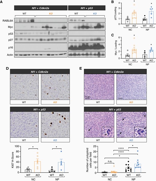 Sustained RABL6A loss leads to paradoxical molecular and pathological alterations indicative of increased malignancy. (A) Representative western blots confirming loss of RABL6A, p16, and p53 in respective conditions. Rabl6 KO mice displayed increased p27 and Myc protein expression in both Nf1 + Cdkn2a (NC) and Nf1 + p53 (NP) tumors. ImageJ quantification of (B) p27 and (C) Myc protein expression. (D) Representative Ki67 IHC images (200X magnification) and H-score quantification reveal Rabl6 KO tumors have enhanced proliferation compared to WT tumors in both NC and NP settings. KO tumors notably also have enlarged cells. (E) Representative H&E images (scale bar, 75 µm) of the indicated tumors reveal increased cancer cell atypia with scattered enlarged cells in Nf1 + p53 altered tumors, which was further enhanced by RABL6A loss. Arrows highlight scattered enlarged cells with large, misshapen and multiple nuclei (morphologically consistent with polyploidy cells), which are magnified in the insets. Below, the number of enlarged cells with polyploidy was quantified and averaged from 5 different fields per tumor. B,C,D,E: Error bars, SEM. B,C,D: P value, Student’s t-test for comparisons between WT and KO tumors for the indicated tumor genotype (*, P < .05). E: P value, Tukey’s multiple comparisons test (*, P < .05; ****, P < .0001).