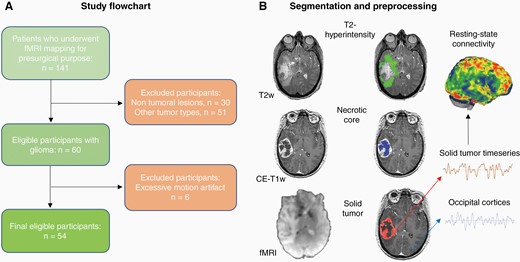 Study flowchart and MRI preprocessing. (A) A retrospective analysis was conducted on all patients who underwent rs-fMRI at BWH (Boston, MA, US) between September 1, 2012 and September 1, 2018 because of a suspected brain focal lesion. (B) Gliomas were manually segmented into their necrotic core/surgical cavity, solid region (mass) and T2-hyperintense area on the basis of T1w and T2w MRI scans. Average BOLD timeseries were extracted from the solid tumor mask of each patient and correlated with the rest of the brain at single voxel-level, using age and gender as covariates. CE-T1w, contrast-enhanced T1w; fMRI, functional Magnetic Resonance Imaging.