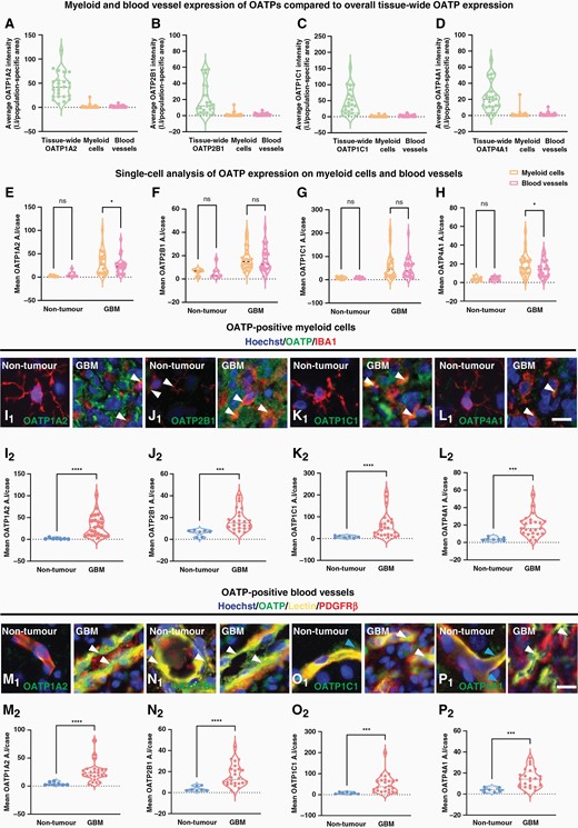 Single-cell average intensity analysis of the cell-type specific expression of OATP1A2, 2B1, 1C1 and 4A1 revealed increased expression on myeloid cells and vasculature in GBM tissue. The tissue-wide expression of OATP1A2 (A), 2B1 (B), 1C1 (C), and 4A1 (D) was compared with single-cell analysis of the average OATP intensity per cell within the OATP-positive—IBA1, and lectin masks in GBM tissue. Single-cell analysis of the mean average intensity per case of each OATP isoform within OATP-positive—IBA1, and lectin masks in tumor and non-tumor tissue (E–H). Pooled single-cell analysis of the mean stain average intensity per cell was compared for each OATP isoform within the IBA1-positive (I–L) and lectin-positive mask (M–P) in GBM and non-tumor tissue. Each of the OATP isoforms was individually compared between GBM and non-tumor tissue with a Mann–Whitney test, data presented as median ± upper and lower quartiles (I–P). Representative images of OATP isoforms in GBM and non-tumor IBA1-positive cells and blood vessels (white arrow), blue arrow denotes vascular associated OATP immunoreactivity; scale bar = 10 μm. Significance was determined using an unpaired Mann–Whitney test. n = 8 cases (non-tumor) n = 25 cases (GBM); *P < .05, ***P < .001, ****P < .0001.