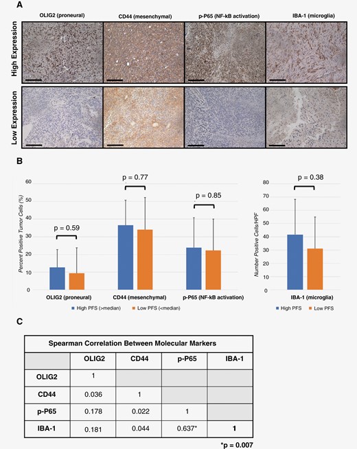 Molecular subtype efficacy analysis. Resected tumors were stained using antibodies against markers for glioblastoma subtypes, NF-κB transcription, and microglia activation. Representative samples with strong or weak expression are shown. (A) Percent or number of positive cells were averaged from tissue corresponding to patients with PFS greater or less than median historical data (scale bar = 100 μm). (B) Pairwise comparison was made between each immunohistochemical marker using Spearman rank correlation. (C) Statistical significance was considered if P ≤ .05. OLIG2, oligodendrocyte transcription factor 2; CD44, cluster of differentiation 44; P-p65, phospho-p65; NF-κB, nuclear factor kappa B; IBA-1, ionized calcium-binding adapter molecule 1; PFS, progression-free survival.