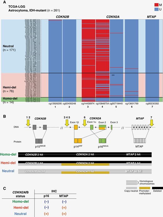 Schematic diagram of CDKNA2A/B and MTAP loci and heatmap showing the methylation status of transcription start sites. (A) Heatmap showing methylation of the transcription start sites at CDKNA2B, CDKN2A, and MTAP loci in cases of The Cancer Genome Atlas-LGG. Cases are aligned by copy number of CDKN2A. CDKN2B and MTAP are unmethylated, whereas CDKN2A has upstream methylations. (B) Schema presents CDKNA2B, CDKN2A, and MTAP loci. The transcription start sites at each locus targeted by the methylation array probes are numbered 1 to 7. The HhaI target of MLPA ME 024 corresponds to CDKN2B (1 − 2) and CDKN2A (3 − 6). In Homo-del, CDKN2A/B and MTAP are deleted in both alleles. In Hemi-del, one allele of CDKN2A is deleted, and the other is silenced by DNA methylation. In Hemi-del, CDKN2A is suppressed by 2 hits but CDKN2B and MTAP are not suppressed, due to a single hit. This explains our IHC results (C) and may explain the gradation of poor prognosis in the order of Homo-del, Hemi-del, and Neutral. CDKN2A/B, cyclin-dependent kinase inhibitor 2A/B; Hemi-del, hemizygous deletion; Homo-del, homozygous deletion; M, methylated; MTAP, methylthioadenosine phosphorylase; Neutral, copy-neutral; U, unmethylated.