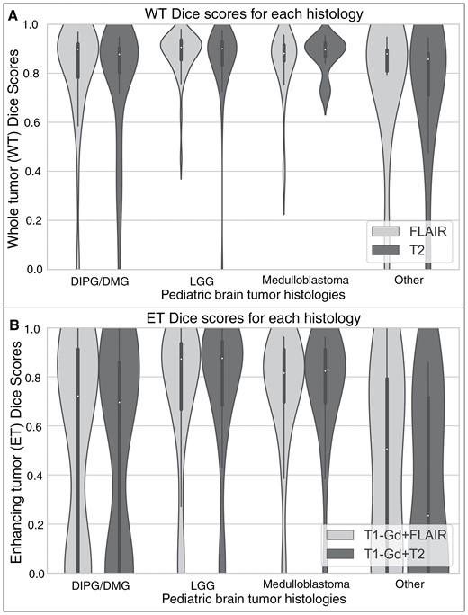 Violin plots showing the distribution of whole tumor (WT) Dice scores using the T2 or FLAIR tumor segmentation model for different histologies (A). There is no significant difference in the Dice scores between T2 and FLAIR inputs for different tumor histologies. Violin plots showing the distribution of enhancing tumor (ET) Dice scores using the T1-Gd and T2 or FLAIR tumor segmentation models for the different histologies (B). Enhancing tumor Dice scores from LGG and medulloblastoma patients were significantly higher than those from DIPG/DMG and other histologies (all P < .0.5).
