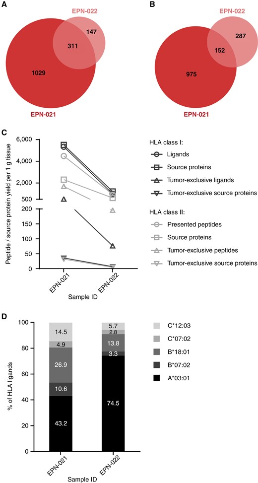 Comparative analysis between the immunopeptidomes of two progressive ZFTA fusion-positive EPNs resected from one patient with a temporal distance of 13 months. Overlap analysis of (A) HLA class I ligands and (B) HLA class II-presented peptides between the first recurrence (EPN-021, sample mass: 460 mg) and the second recurrence (EPN-022, sample mass: 251 mg). (C) Alterations in immunopeptidomes yields between both tumors. Yields of the second recurrence EPN-022 were normalized to the mass of the smaller sample EPN-021. (D) Distribution of HLA restrictions of HLA class I ligands in the first and the second recurrence.