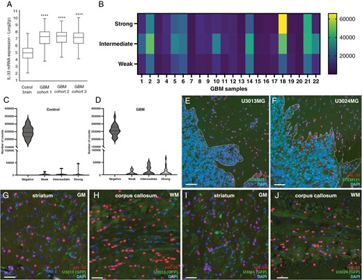 Expression of IL-33 in GBM patients and in xenograft models of glioma. (A) Analysis of publicly available IL-33 mRNA expression data from 3 GBM cohorts26–28 compared to control brains.25 Expression levels were normalized and presented as fold change. (B) Heat map showing quantification of IL-33 immunolabeling in 22 tumor cores from GBM patients in a tissue microarray (TMA). Automated quantification is presented as staining intensity (weak, intermediate, or strong). (C,D) Violin plots showing quantification of the immunolabelling intensity of IL-33 staining control brain and GBM. Two-way ANOVA of control brain cores versus all GBM cores, P = .075. (E, G, H) Expression of murine IL-33 in xenograft mouse models derived by injecting human GBM cells U3013, and (F, I, J) U3024 cells in immunodeficient mouse striatum. The distribution of murine IL-33-expressing cells was examined in cells directly surrounding the tumor mass (E, F, demarcated by dotted line), gray matter of striatum (G, I), and white matter of corpus callosum (H, J). Human cells, stained with STEM121 antibodies. Blue DAPI nucelar stain. Representative data from three mice for each GBM cell line injected. Data are presented as mean ± SD, ****P < .0001. Scale bar 50 µm.