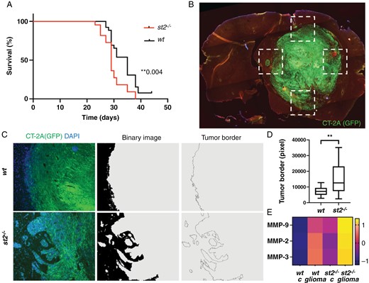 Increased glioma aggressiveness in ST2-deficient mice. (A) Kaplan–Meier analysis showing shorter survival times in ST2-deficient mice (n = 30) with CT-2A glioma, compared to wt mice (n = 30). (B-C) Image processing to measure the length of the tumor border in ST2-deficient and wt mice. (D) Quantification of the tumor border length, with longer borders observed in ST2-deficient mice compared to wt. (E) Increased matrix metalloproteinases (MMP2, MMP3, and MMP9) in the serum of ST2-deficient mice, further enhanced in ST2-deficient mice with tumors. Scale bars: 1 mm (B) and 50 µm (C). (B-D) Results are representative of three biological replicates with 10 mice per group in each repeat. Data are presented as mean ± SD. Scale bar 50 µm.