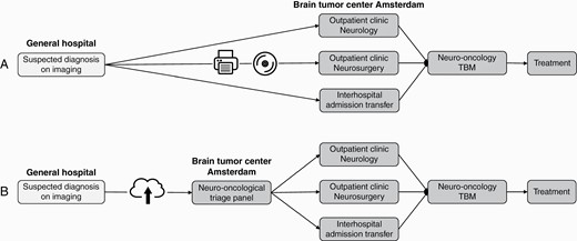Referral pathways. (A) Pathway of the standard referral. (B) Pathway of NOTP referral. Abbreviations: NOTP, neuro-oncological triage panel; TBM, tumor board meeting.