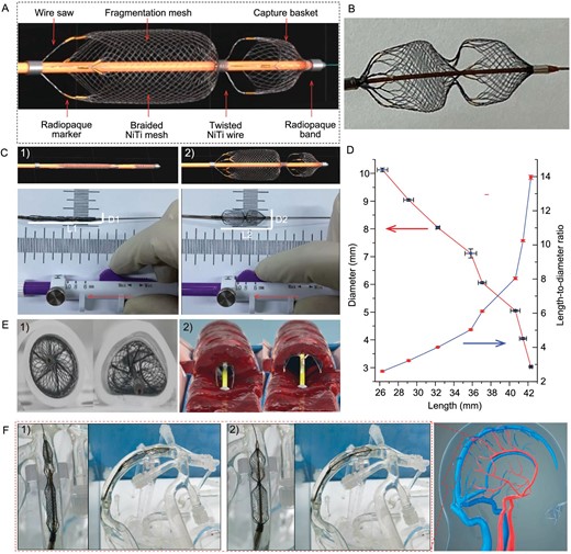 Demonstration of the Venus-TD. (A) Design and structure of the device. (B) Photo of the device. (C) Photos of the geometrical changes of the device with a controllable length/diameter ratio. (D) Changes of the stent diameters in different lengths, as well as the related length-to-diameter ratios. (E) Photos of stent apposition in silicone tubes with (1) typical geometric cross sections and (2) illustration of transverse fragmentation of the thrombus. (F) Simulated delivery of the device into the SSS within the cerebral venous models under (1) elongated and (2) expanded states.
