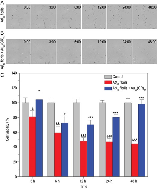 (A, B) In situ real-time morphological changes of PC-12 cells co-incubated with freshly preformed Aβ40 fibrils without (A) or with 50 mg·L−1 Au23(CR)14 (B). (C) Viabilities of PC-12 cells after Aβ40 fibril treatment in the absence (red) and presence (blue) of 50 mg·L−1 Au23(CR)14 for 3, 6, 12, 24 and 48 h. No treatment was included as the blank control (gray). Student's t-test: n = 5, *P < 0.05, ***P < 0.001 vs. Aβ40 fibrils-induced group; &P < 0.05, &&P < 0.01, &&&P < 0.001 vs. control.