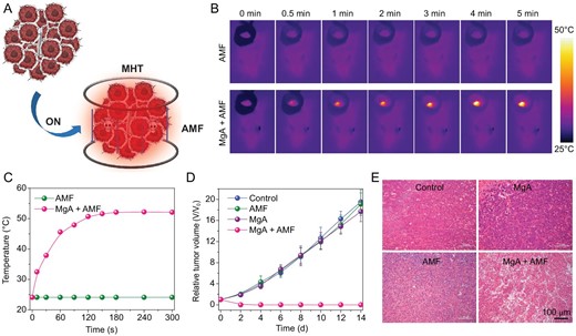 In vivo MHT treatment of 4T1 mouse tumors with MgA rods. (A) Schematic illustration of MHT with MgA rods to ablate tumors in mice. Infrared thermal images (B) and temperature change curves (C) of tumors in mice with or without implantation of MgA rods under AMF. (D) The growth curves of tumors after various treatments. (E) H&E stained tumor slices collected from different treatment groups.