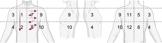 schematic of lung zones and probe movement. Zone 1/2: example for longitudinal sweep; zone 7/8: example for intercostal sweeps.