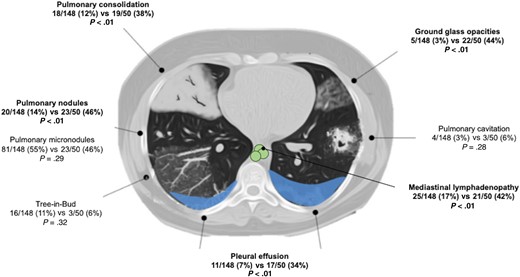 Pulmonary imaging findings comparing patients living with HIV vs OIC patients without HIV.