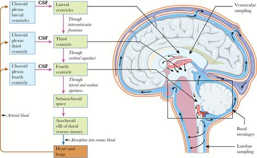 CSF is produced in the choroid plexus of the lateral, third, and fourth ventricles. The CSF flows unidirectionally from the lateral ventricle to the third ventricle, to the fourth ventricle, and then to the subarachnoid space in the region of the basal meninges. Ventricular sampling of the CSF is from the lateral ventricles, and lumbar sampling is from the lumbar cisterns in communication with the subarachnoid space. Only a minority of CSF flows into the lumbar cisterns, with the rest reabsorbed by the arachnoid villi of the dural venous sinuses. Abbreviation: CSF, cerebrospinal fluid.