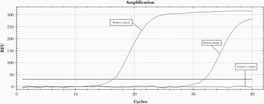 Real-time PCR result for C. burnetii detection. Red line: commercially available positive DNA control; black line: Milli-Q type I water negative control; green line: patient’s positive result with a cycle threshold of 31.8. Abbreviations: PCR, polymerase chain reaction; RFU, Relative Fluorescence Units.
