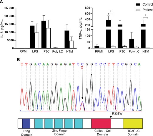 A, Peripheral blood mononuclear cells from the patient (white bar, patient) and healthy volunteers (black bar, control, n = 7) were stimulated with LPS, P3C, Poly I:C and Mycobacterium abscessus (NTM), or RPMI. Culture supernatants were harvested, and concentrations of IL-6 and TNF-α were measured. Data were pooled from 3 experiments. *P < .05 based on Mann Whitney U test. B, Sanger sequence demonstrating the heterozygous cytosine C to thymine T switch at the c.1012 exon 11 of TRAF3 in the proband and location of R338W in the predicted structure by domains of TRAF3. Abbreviations: IL-6, interleukin 6; LPS, lipopolysaccharide; NTM, nontuberculous mycobacteria; P3C, Pam3Cys; TNF-α, tumor necrosis factor alpha.