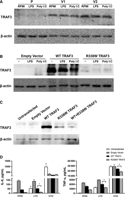 A, Western blot for TRAF3 in PBMCs from the patient (P) and healthy volunteers (V1 and V2). PBMCs were isolated from the patient and healthy volunteers and were unstimulated (RPMI) or stimulated with LPS or Poly I:C and showed diminished TRAF3 expression in patient cells. Data representative of 2 independent experiments are shown. B, Empty vector, wild-type (WT TRAF3), and mutant (R338W TRAF3) plasmids were transfected in HEK 293FT cells. Twenty-four hours after transfection, cells were stimulated with LPS or Poly I:C for 24 hours. Western blot analysis demonstrated diminished TRAF3 expression in transfected R338W cells compared with WT. Data are representative of 2 independent experiments. C, Empty vector, wild-type (WT TRAF3), mutant (R338W TRAF3) plasmids were transfected in RAW264.7 cells. The cells were also transfected with equal amounts of both plasmids (WT + R338W TRAF3). Western blot was performed on the cells 48 hours after transfection. Diminished TRAF3 expression was observed in R338W and WT + R338W TRAF3–transfected cells compared with WT. Data representative of 2 independent experiments are shown. D, Empty vector, wild-type (WT TRAF3), and mutant (R338W TRAF3) plasmids were transfected in RAW264.7 cells. The transfected cells were stimulated after 24 hours with LPS or NTM. ELISA for mouse IL-6 and TNF-α was performed on the cell supernatants 24 hours after stimulation. Data were pooled from 2 experiments. *P < .05 based on Mann-Whitney U test. Abbreviations: ELISA, enzyme-linked immunosorbent assay; IL-6, interleukin 6; LPS, lipopolysaccharide; NTM, nontuberculous mycobacteria; PBMC, peripheral blood mononuclear cell; TNF-α, tumor necrosis factor alpha; WT, wild-type.