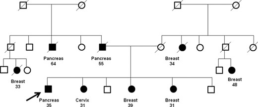 BRCA1突变和胰腺癌患者的家族系谱。