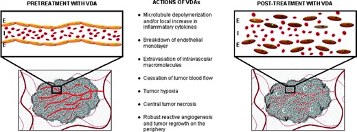 Purported mechanism of action of tumor VDAs: Disruption of the newly formed tumor vasculature renders them nonfunctional and results in a viable rim of tumor cells supplied by the nearby nontumor normal vasculature.