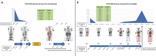 ctDNA PTCH1 mutation dynamics during treatment with first-line platinum-based chemotherapy and second-line vismodegib. (A) The figure shows clearance of the PTCH1 mutation in plasma after 3 cycles of 3-weekly carboplatin-etoposide, being concordant with the near-complete response on the 18F-FDG PET/TC scan from December 2019. Treatment was temporarily stopped in late January 2020 to allow for the collection of progenitor bone marrow cells for a future treatment with high-dose chemotherapy followed by an autologous bone marrow transplant. However, due to the advent of the COVID-19 pandemic, such treatment plan was abandoned to avoid the risks of severe immunosuppression. Tumor progression occurred in March 2023, and treatment with cyclophosphamide-carboplatin-etoposide was restarted in early April 2020, and administered for 3 cycles, leading to a major partial response. PTCH1 ctDNA was negative at 3 different time points during this period, possibly due to the tumor responding to chemotherapy. For more details, please refer to the main text. (B) The figure shows clearance of the PTCH1 mutation in plasma after 3 weeks of treatment with vismodegib and being detectable again at very low MAF in November 2020 and then clearing again until June 2021, being concordant with the near-complete response seen on the 18F-FDG PET/TC scan between November 2020 and February 2021. ctDNA levels started rising in June 2021 and peaked in October 2021, mirroring the radiological disease-progression observed in May, August, and October 2021. Interestingly a dramatic decrease in PTCH1 ctDNA occurred after stopping treatment with vismodegib, that paralleled the symptomatic improvement of the patient, possibly reflecting decreased treatment pressure, although this only lasted for a couple of weeks. Unfortunately, no subsequent blood collections were performed to monitor PTCH1 ctDNA when vismodegib was rechallenged between November 2021 and January 2022 with initial symptomatic improvement but no radiological response. Abbreviation: MAF: mutant-allele frequency. Arrows and boxes in blue tumor lesions that respond or progress as indicated in the figure..